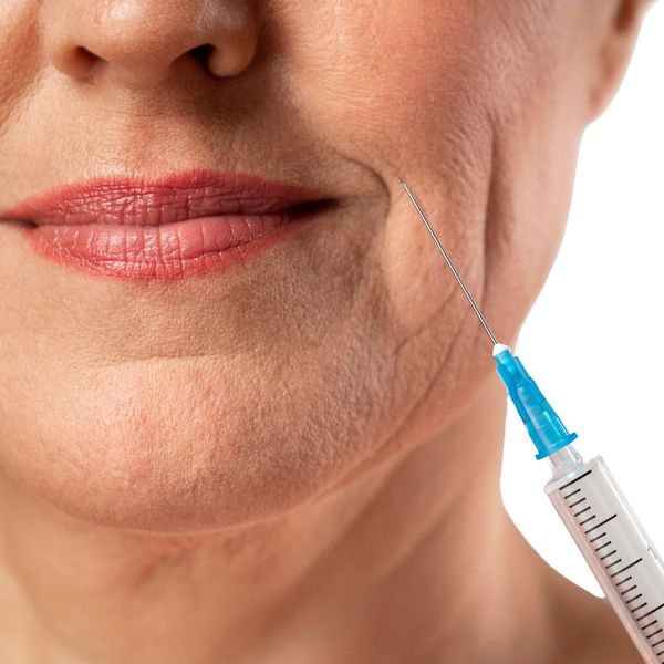 Kvinne med rynker, Hudinjeksjon